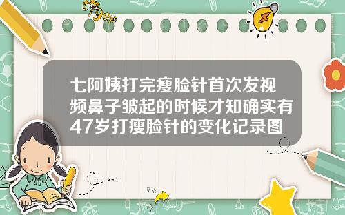 七阿姨打完瘦脸针首次发视频鼻子皱起的时候才知确实有47岁打瘦脸针的变化记录图