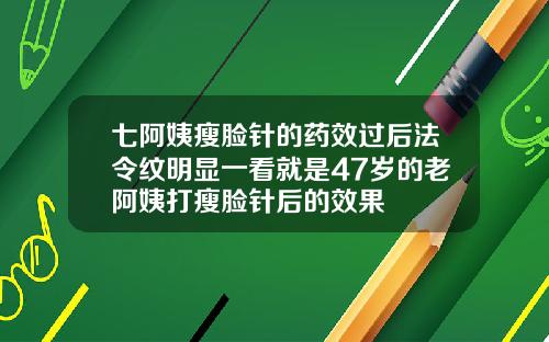 七阿姨瘦脸针的药效过后法令纹明显一看就是47岁的老阿姨打瘦脸针后的效果
