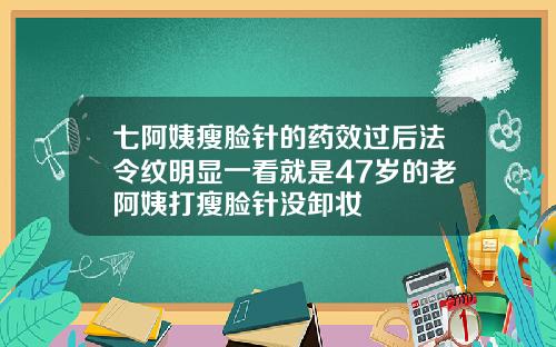 七阿姨瘦脸针的药效过后法令纹明显一看就是47岁的老阿姨打瘦脸针没卸妆
