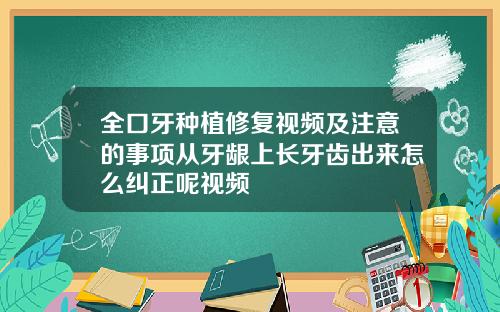 全口牙种植修复视频及注意的事项从牙龈上长牙齿出来怎么纠正呢视频