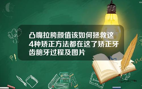 凸嘴拉胯颜值该如何拯救这4种矫正方法都在这了矫正牙齿龅牙过程及图片