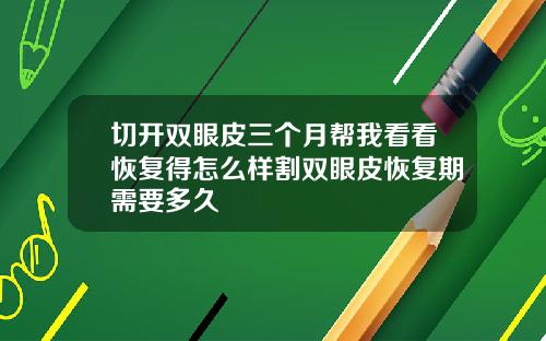 切开双眼皮三个月帮我看看恢复得怎么样割双眼皮恢复期需要多久