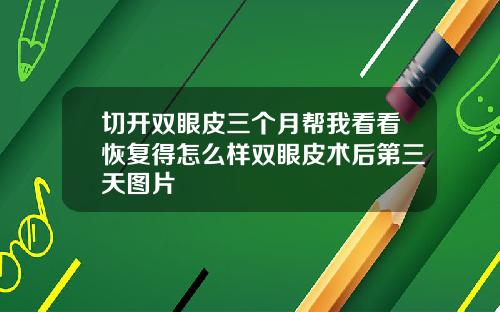 切开双眼皮三个月帮我看看恢复得怎么样双眼皮术后第三天图片