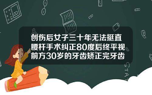 创伤后女子三十年无法挺直腰杆手术纠正80度后终平视前方30岁的牙齿矫正完牙齿多久可以看出效果
