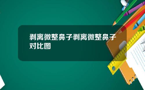 剥离微整鼻子剥离微整鼻子对比图