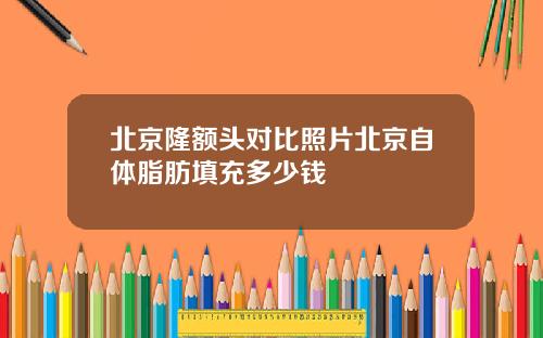 北京隆额头对比照片北京自体脂肪填充多少钱