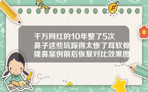 千万网红的10年整了5次鼻子这些坑踩得太惨了耳软骨隆鼻案例前后恢复对比效果图