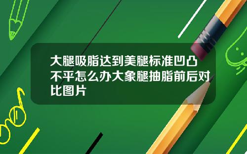 大腿吸脂达到美腿标准凹凸不平怎么办大象腿抽脂前后对比图片