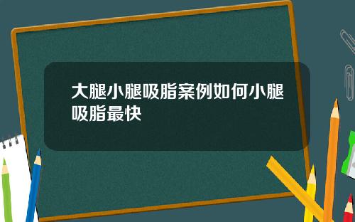大腿小腿吸脂案例如何小腿吸脂最快