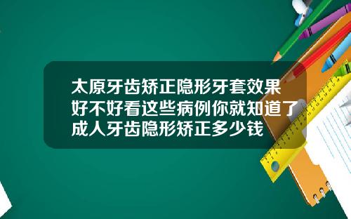 太原牙齿矫正隐形牙套效果好不好看这些病例你就知道了成人牙齿隐形矫正多少钱