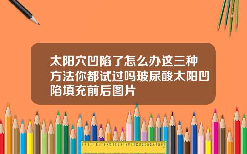 太阳穴凹陷了怎么办这三种方法你都试过吗玻尿酸太阳凹陷填充前后图片