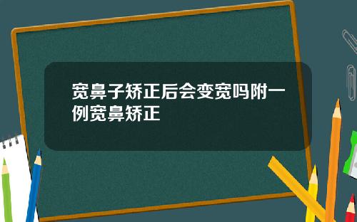 宽鼻子矫正后会变宽吗附一例宽鼻矫正