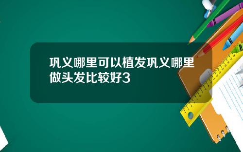 巩义哪里可以植发巩义哪里做头发比较好3