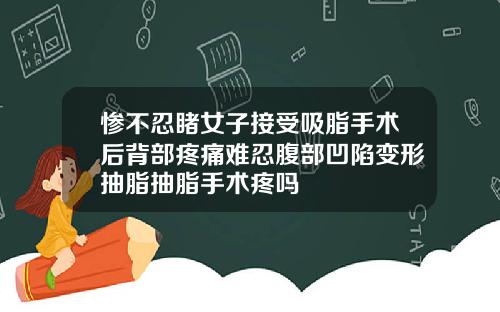 惨不忍睹女子接受吸脂手术后背部疼痛难忍腹部凹陷变形抽脂抽脂手术疼吗
