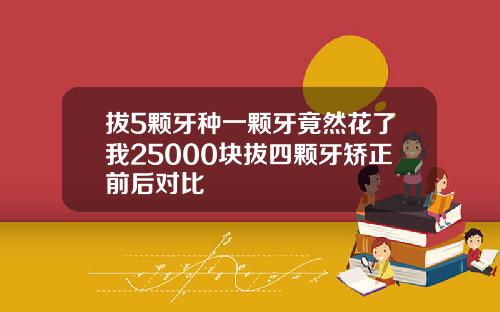 拔5颗牙种一颗牙竟然花了我25000块拔四颗牙矫正前后对比