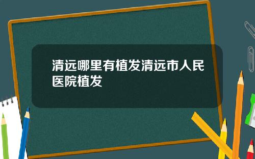 清远哪里有植发清远市人民医院植发