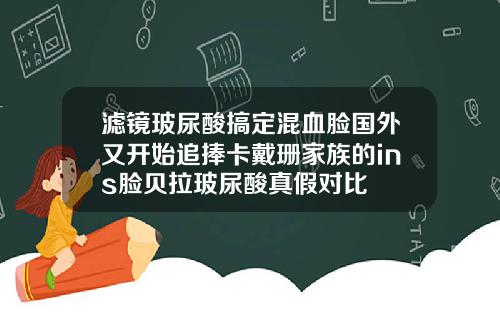 滤镜玻尿酸搞定混血脸国外又开始追捧卡戴珊家族的ins脸贝拉玻尿酸真假对比