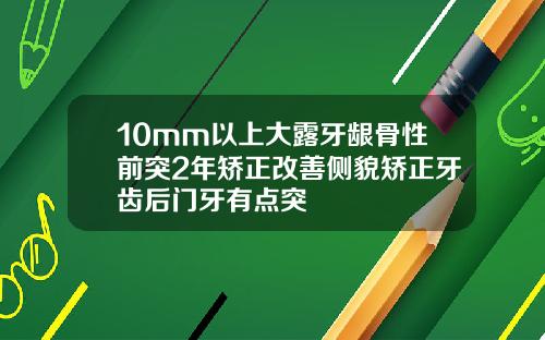10mm以上大露牙龈骨性前突2年矫正改善侧貌矫正牙齿后门牙有点突