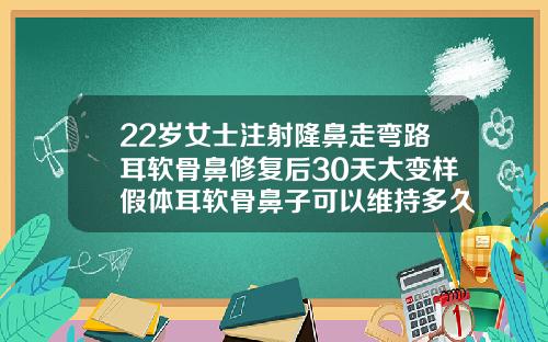 22岁女士注射隆鼻走弯路耳软骨鼻修复后30天大变样假体耳软骨鼻子可以维持多久