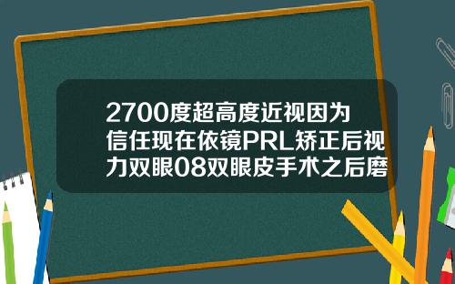 2700度超高度近视因为信任现在依镜PRL矫正后视力双眼08双眼皮手术之后磨眼睛