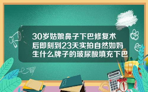 30岁姑娘鼻子下巴修复术后即刻到23天实拍自然如妈生什么牌子的玻尿酸填充下巴好