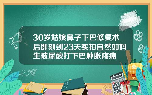 30岁姑娘鼻子下巴修复术后即刻到23天实拍自然如妈生玻尿酸打下巴肿胀疼痛