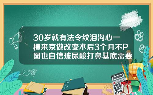30岁就有法令纹泪沟心一横来京做改变术后3个月不P图也自信玻尿酸打鼻基底需要几只