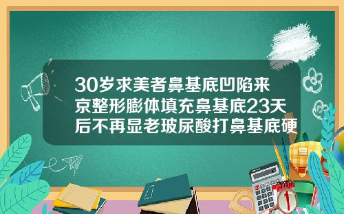 30岁求美者鼻基底凹陷来京整形膨体填充鼻基底23天后不再显老玻尿酸打鼻基底硬硬的什么时候软化