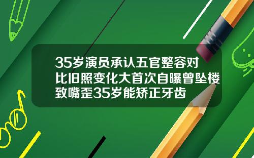 35岁演员承认五官整容对比旧照变化大首次自曝曾坠楼致嘴歪35岁能矫正牙齿