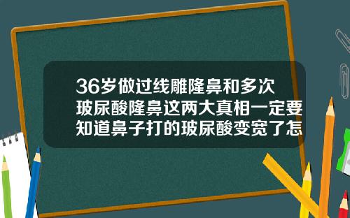 36岁做过线雕隆鼻和多次玻尿酸隆鼻这两大真相一定要知道鼻子打的玻尿酸变宽了怎么办图片