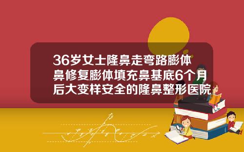 36岁女士隆鼻走弯路膨体鼻修复膨体填充鼻基底6个月后大变样安全的隆鼻整形医院排名