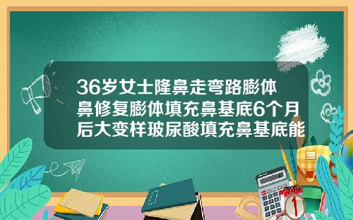 36岁女士隆鼻走弯路膨体鼻修复膨体填充鼻基底6个月后大变样玻尿酸填充鼻基底能保持多久