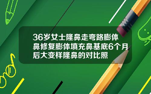 36岁女士隆鼻走弯路膨体鼻修复膨体填充鼻基底6个月后大变样隆鼻的对比照