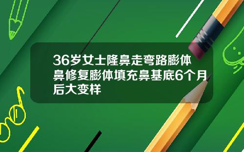 36岁女士隆鼻走弯路膨体鼻修复膨体填充鼻基底6个月后大变样