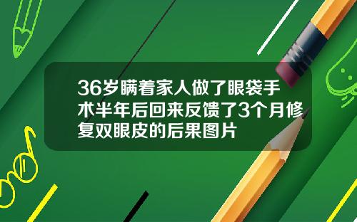 36岁瞒着家人做了眼袋手术半年后回来反馈了3个月修复双眼皮的后果图片