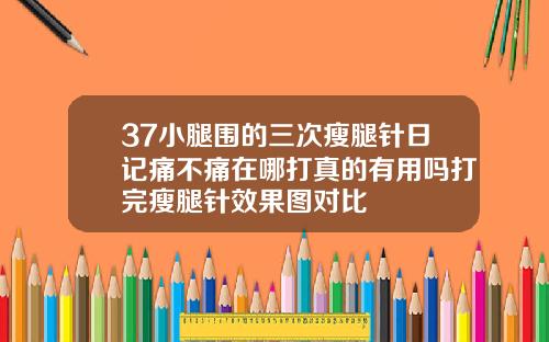 37小腿围的三次瘦腿针日记痛不痛在哪打真的有用吗打完瘦腿针效果图对比