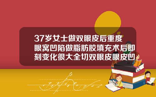 37岁女士做双眼皮后重度眼窝凹陷做脂肪胶填充术后即刻变化很大全切双眼皮眼皮凹陷
