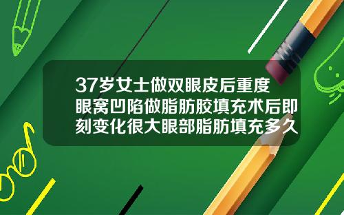 37岁女士做双眼皮后重度眼窝凹陷做脂肪胶填充术后即刻变化很大眼部脂肪填充多久恢复自然