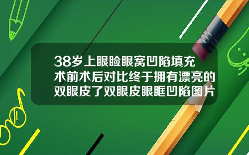 38岁上眼睑眼窝凹陷填充术前术后对比终于拥有漂亮的双眼皮了双眼皮眼眶凹陷图片
