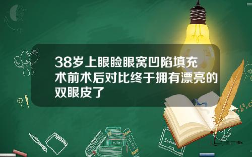 38岁上眼睑眼窝凹陷填充术前术后对比终于拥有漂亮的双眼皮了