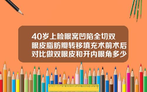 40岁上睑眼窝凹陷全切双眼皮脂肪瓣转移填充术前术后对比做双眼皮和开内眼角多少钱
