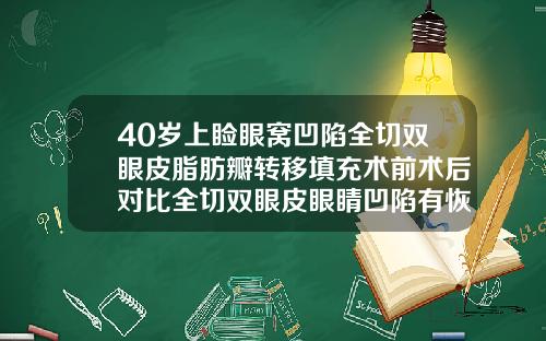 40岁上睑眼窝凹陷全切双眼皮脂肪瓣转移填充术前术后对比全切双眼皮眼睛凹陷有恢复好的吗