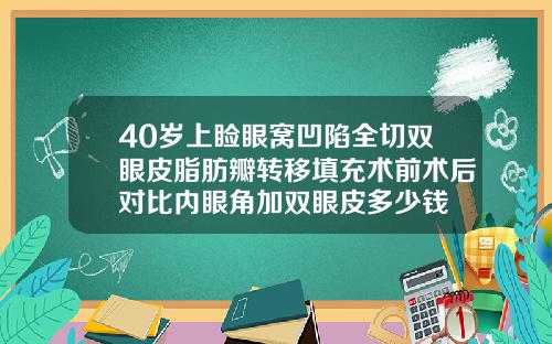40岁上睑眼窝凹陷全切双眼皮脂肪瓣转移填充术前术后对比内眼角加双眼皮多少钱