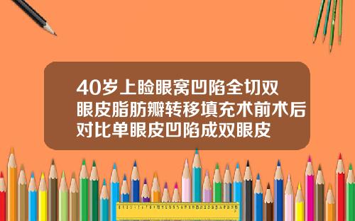 40岁上睑眼窝凹陷全切双眼皮脂肪瓣转移填充术前术后对比单眼皮凹陷成双眼皮