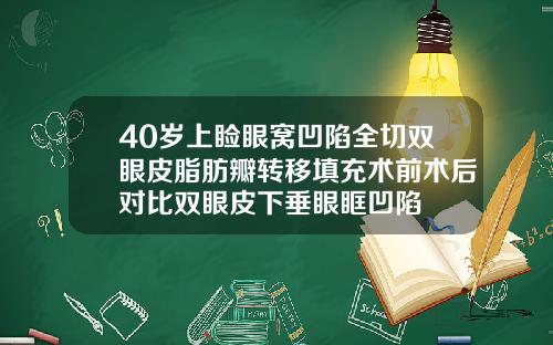 40岁上睑眼窝凹陷全切双眼皮脂肪瓣转移填充术前术后对比双眼皮下垂眼眶凹陷