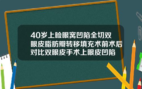 40岁上睑眼窝凹陷全切双眼皮脂肪瓣转移填充术前术后对比双眼皮手术上眼皮凹陷