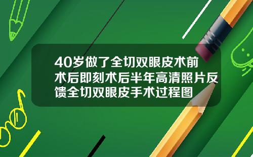 40岁做了全切双眼皮术前术后即刻术后半年高清照片反馈全切双眼皮手术过程图