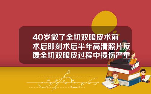 40岁做了全切双眼皮术前术后即刻术后半年高清照片反馈全切双眼皮过程中损伤严重能恢复吗