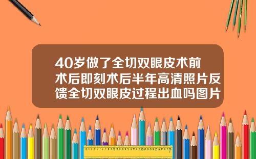 40岁做了全切双眼皮术前术后即刻术后半年高清照片反馈全切双眼皮过程出血吗图片