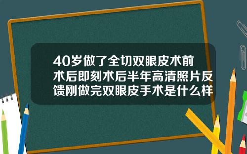 40岁做了全切双眼皮术前术后即刻术后半年高清照片反馈刚做完双眼皮手术是什么样子的图片